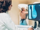 Mamografia: o exame aumenta as chances de cura do câncer de mama